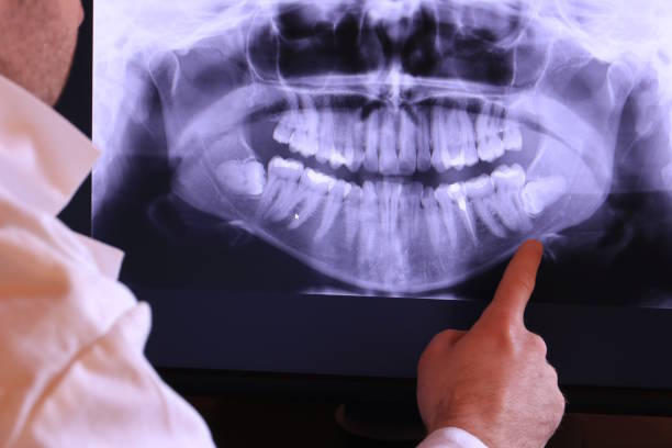 Best Chipped Tooth Repair Near Me  in Buxton, NC