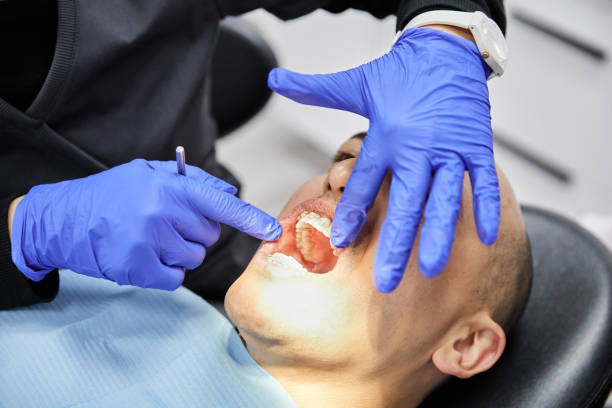 Best Knocked-Out Tooth Emergency  in Buxton, NC