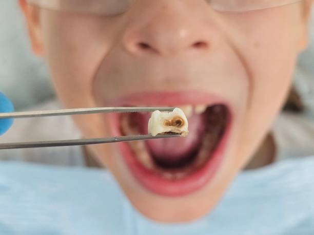 Best Cracked Tooth Emergency Dentist  in Buxton, NC