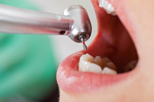 Best Cracked Tooth Emergency Dentist  in Buxton, NC